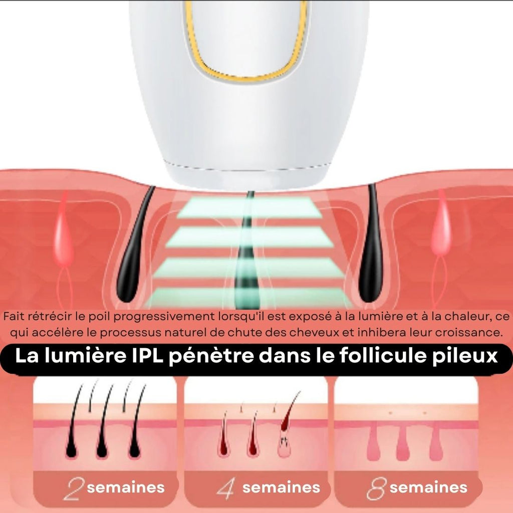Epilateur à lumière pulsée